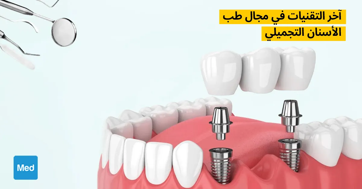 آخر التقنيات في مجال طب الأسنان التجميلي
